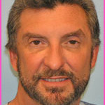 Dr. Manuel Miguel Pena, MD - Naples, FL - Plastic Surgery, Hand Surgery