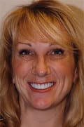 Dr. Mark R Gadberry, DDS - Covina, CA - Dentistry