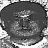 Dr. Aaron Hao Jun, MD