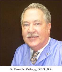 Dr. Brent Nelson Kellogg - Everett, WA - Dentistry