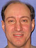 Dr. Stephen Frank Coccaro, MD