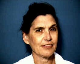 Dr. Elisabeth Anne Mailhot, MD - San Jose, CA - Pathology, Nuclear Medicine
