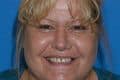 Dr. Karen G Glerum, DDS - Boynton Beach, FL - Dentistry