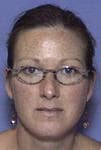 Dr. Catherine Carey Mcgowan, MD - Nashville, TN - Infectious Disease, Internal Medicine